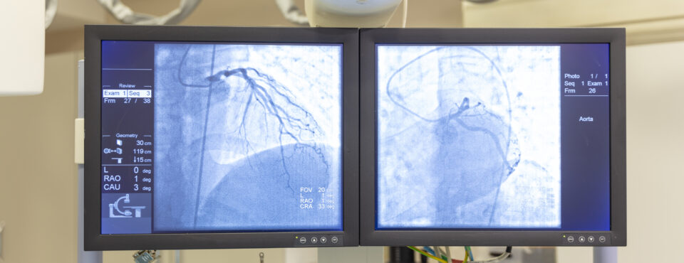 imaging results on computer monitor